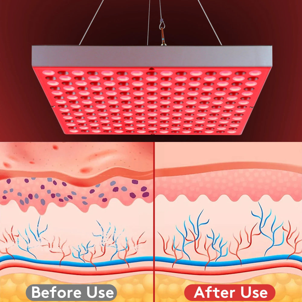 Red Light Panel 225 LEDs Infrared Therapy Panel Skin Repair Anti-Ageing Pain Relief 31cm / 12inch-red light therapy-Genie Health+Beauty Store